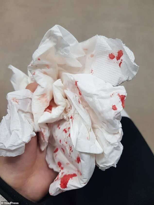 Mr Sheng, who did not want to identify his girlfriend because the incident traumatised her, said he was 'punched in the face trying to protect her'