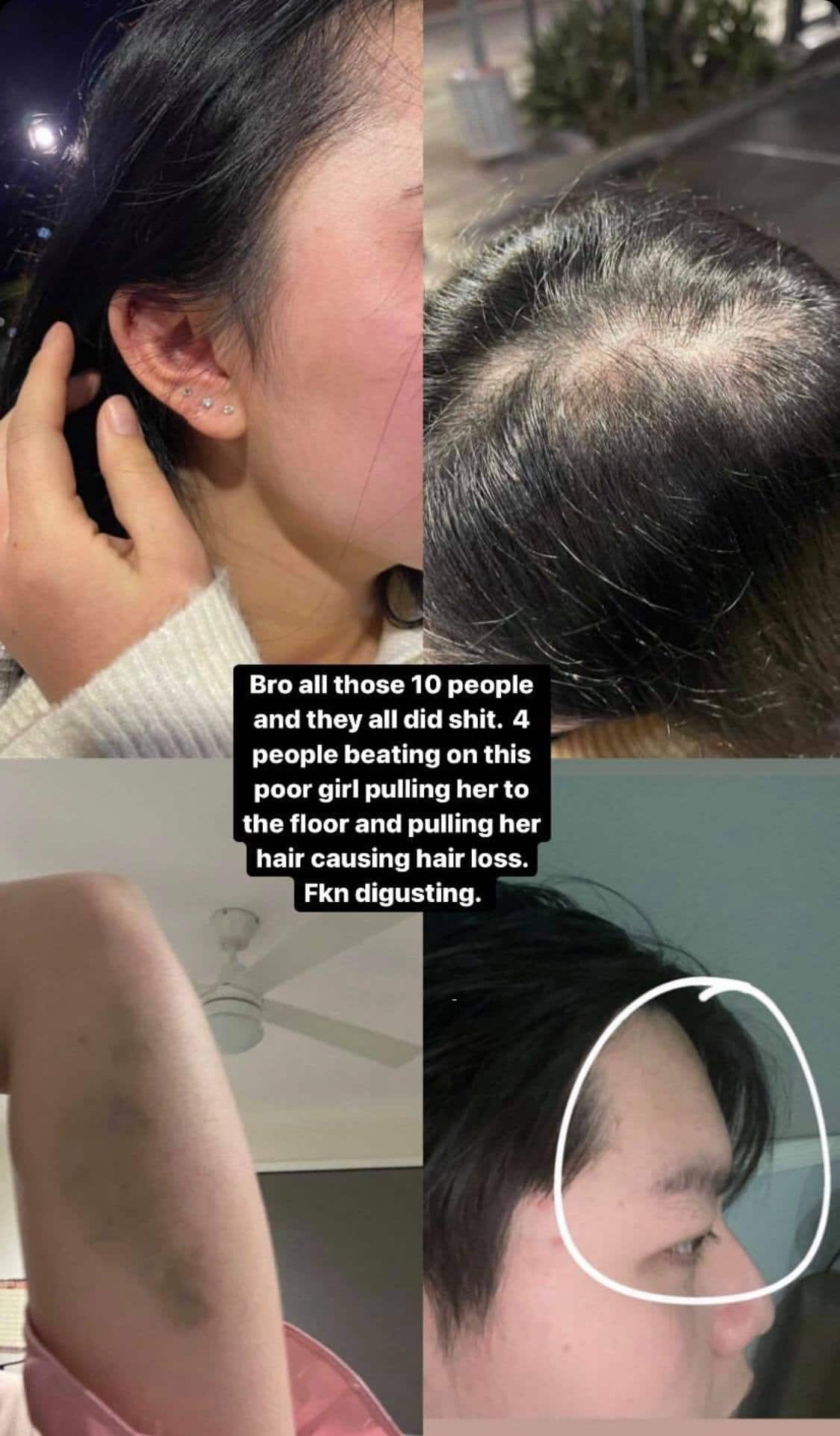 Ba nạn nhân và vết tích sau khi bị đánh