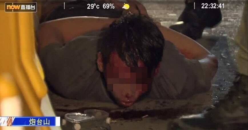 Amnesty warns of Hong Kong police torture