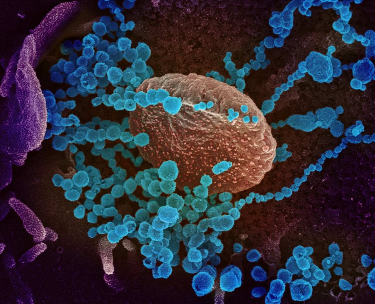 Scanning electron microscope from the National Institutes of Health image of SARS-CoV-2 emerging from the surface of cells cultured in the lab.