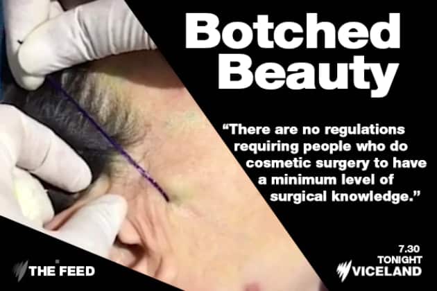 Botched Beauty