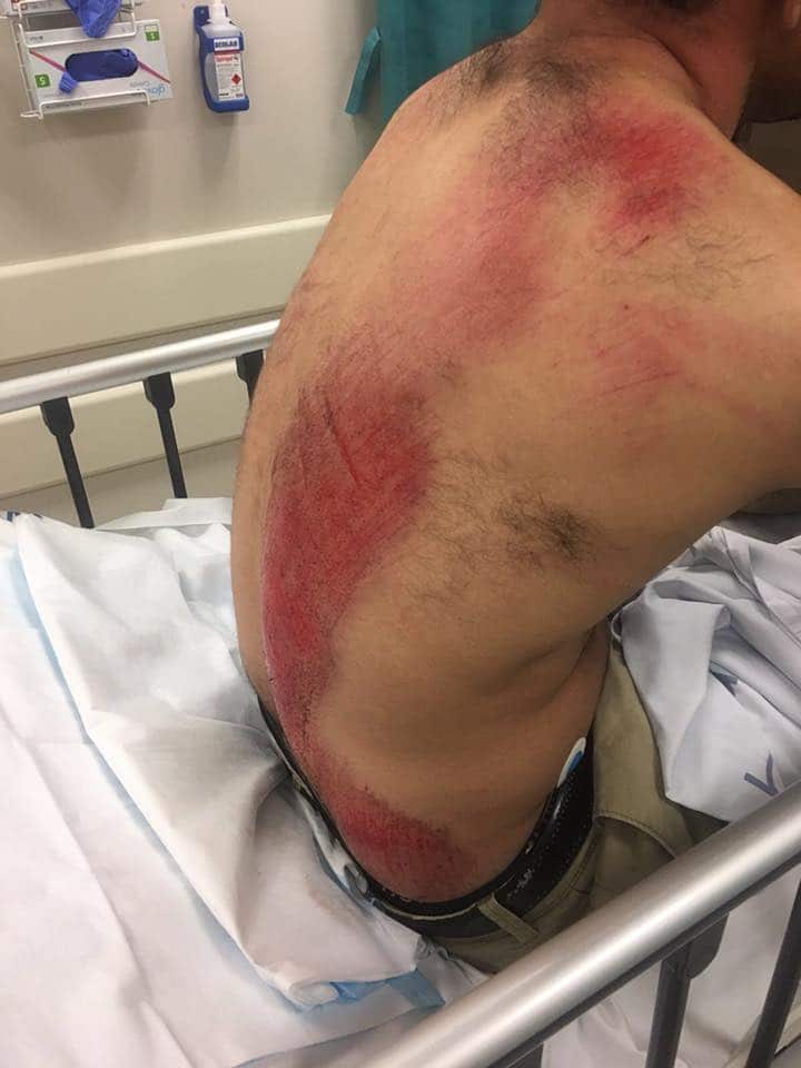 Uber driver attacked, driver attacked in Melbourne