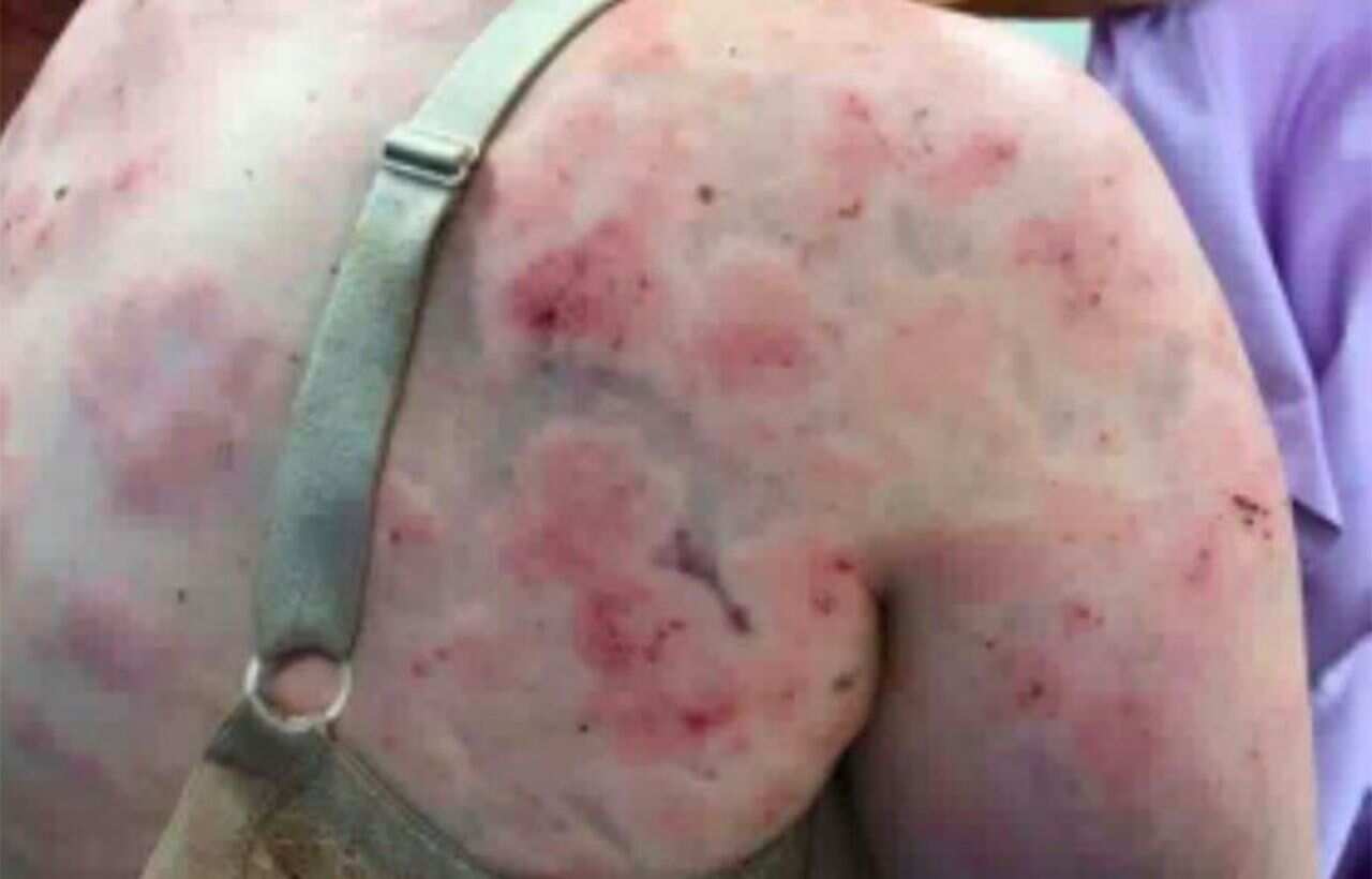 The mother leaped into the back seat and put her body between her baby and the hailstones when a back window shattered.