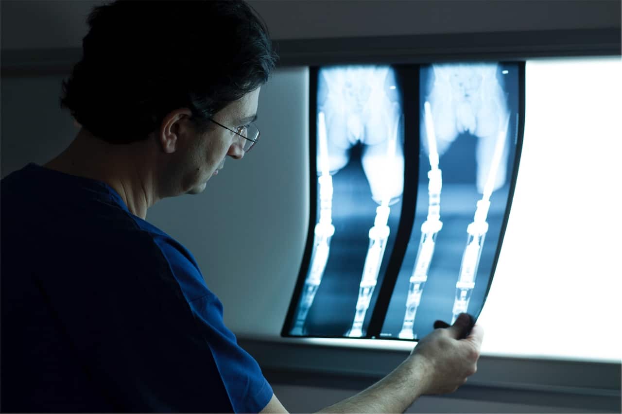 Dr Munjed Al Muderis x-ray