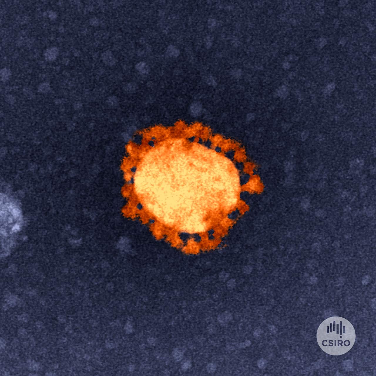 An image of the coronavirus responsible for causing the disease COVID-19.