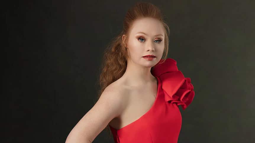 Madeline Stuart, World's first Supermodel With Down Syndrome