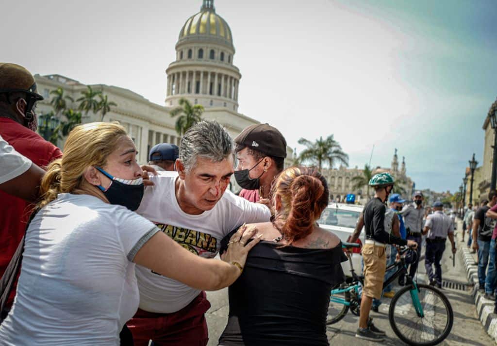 A man injured in the eye is seen during a demonstration against the government of Cuban President Miguel Diaz-Canel in Havana, on 11 July, 2021. 