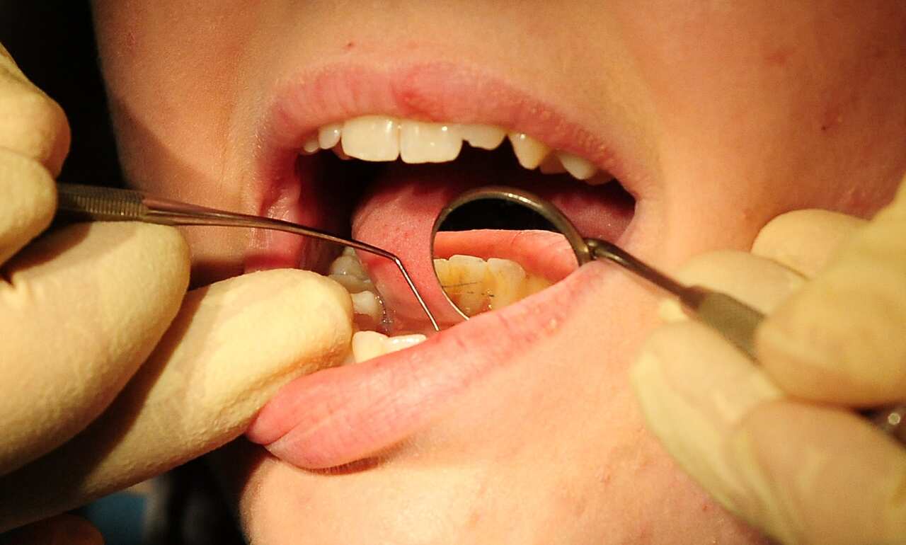  A dentist works on a patient.