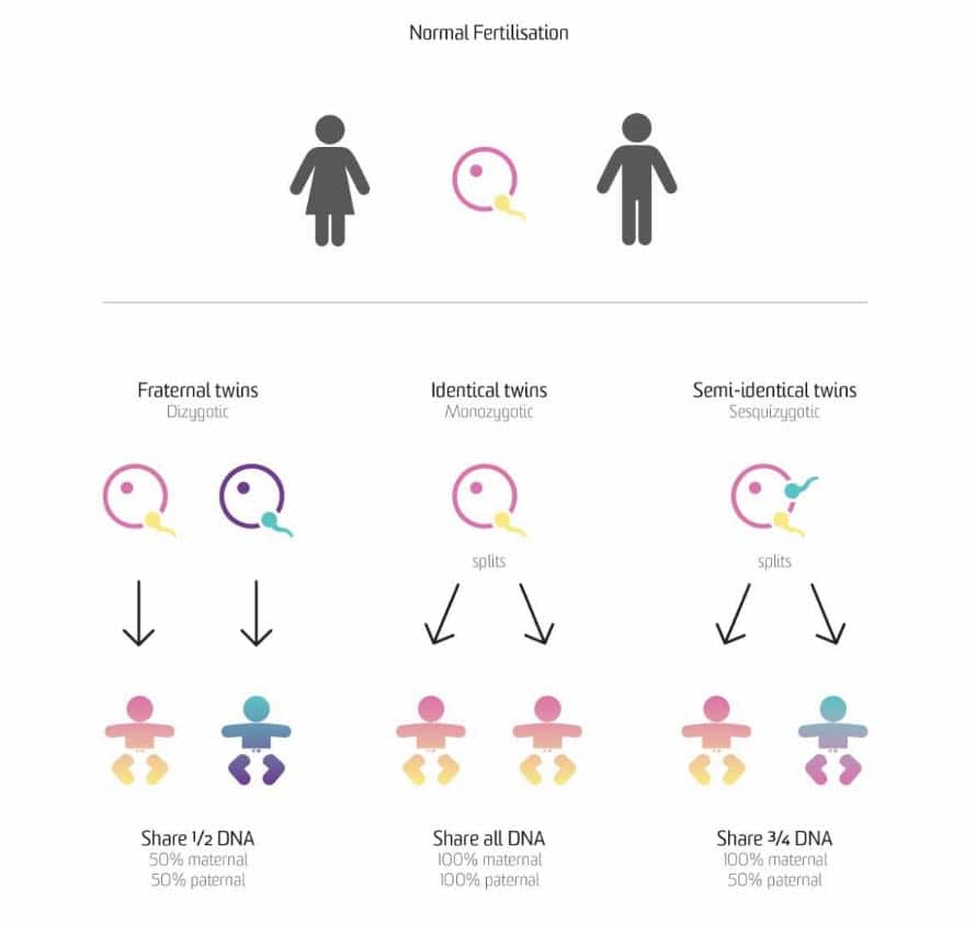 A chart explaining how different types of twins are conceived