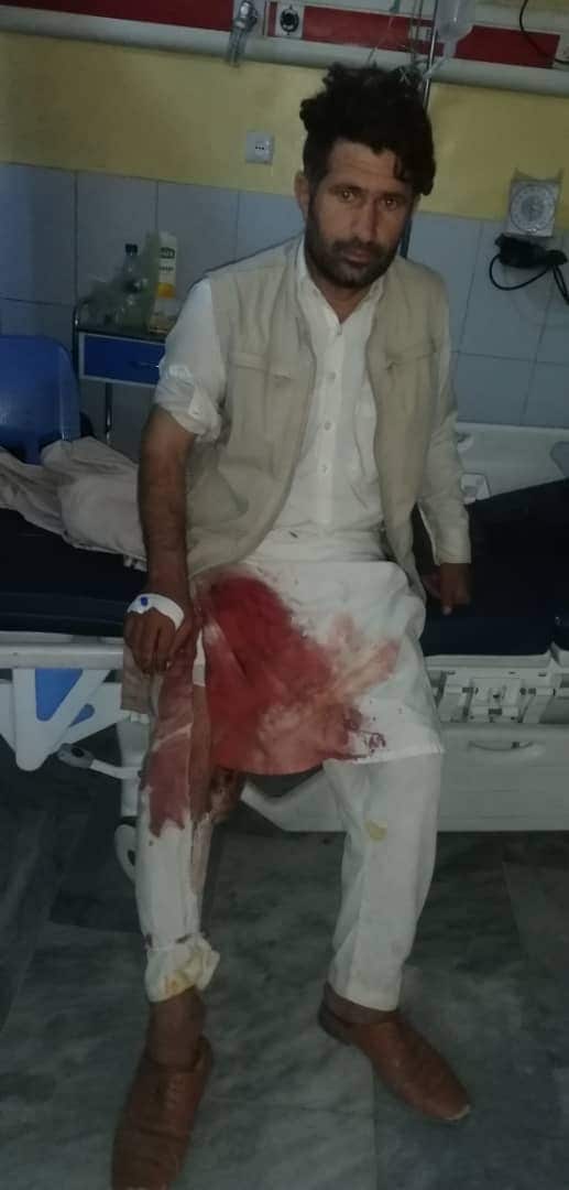 Malik in hospital after sustaining a gunshot to his leg at Kabul airport
