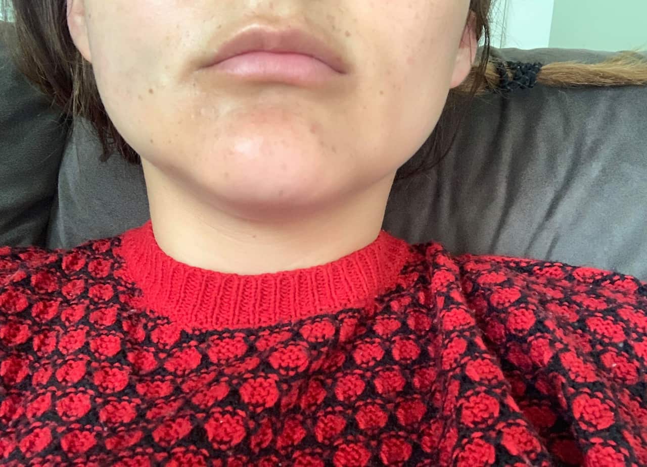 Colombianas golpeadas en supuesto ataque racista en N. Z.