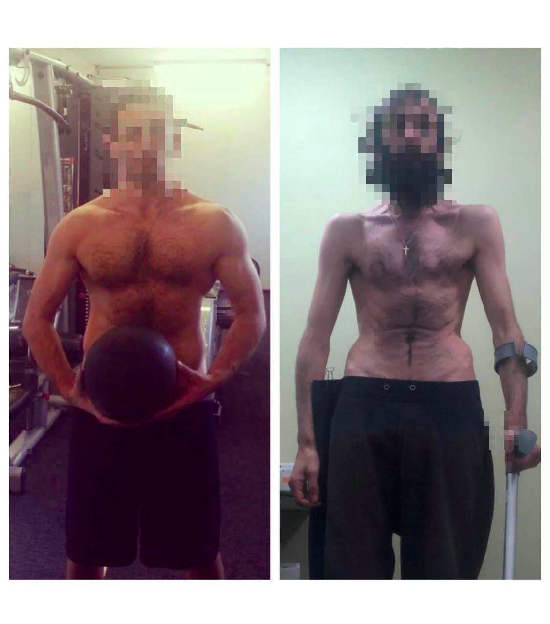 The man had been in detention in Melbourne until March this year and was due to be deported last year