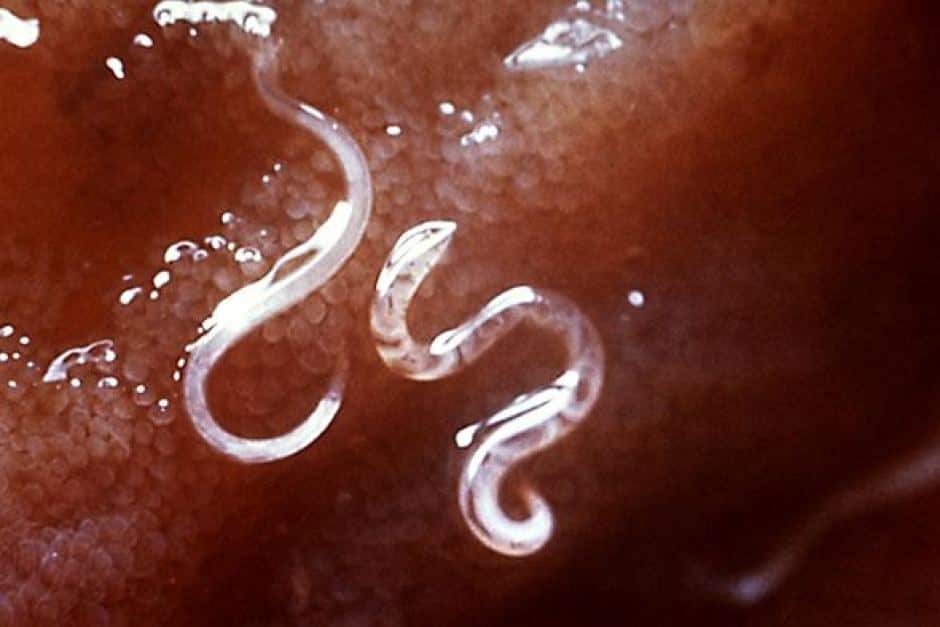 The hookworm eventually heads for the gut where it feeds off the host's blood.