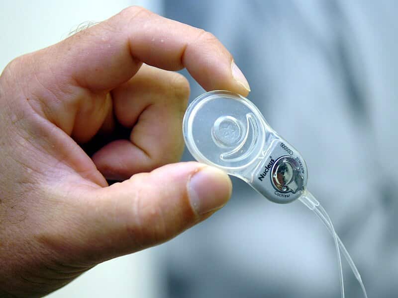 A bionic ear device in Melbourne