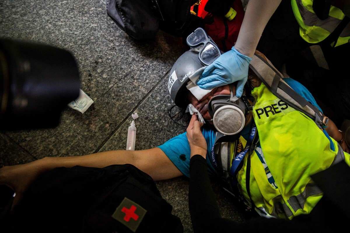 Journalist left blind by rubber bullet in Hong Kong