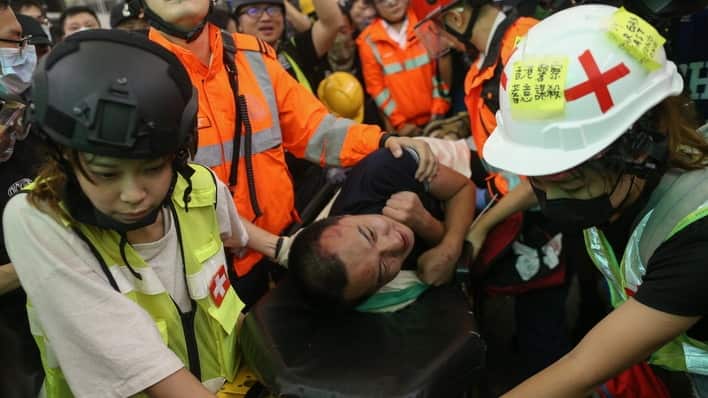 An injured man whom protesters accused of being an undercover police officer (AAP)
