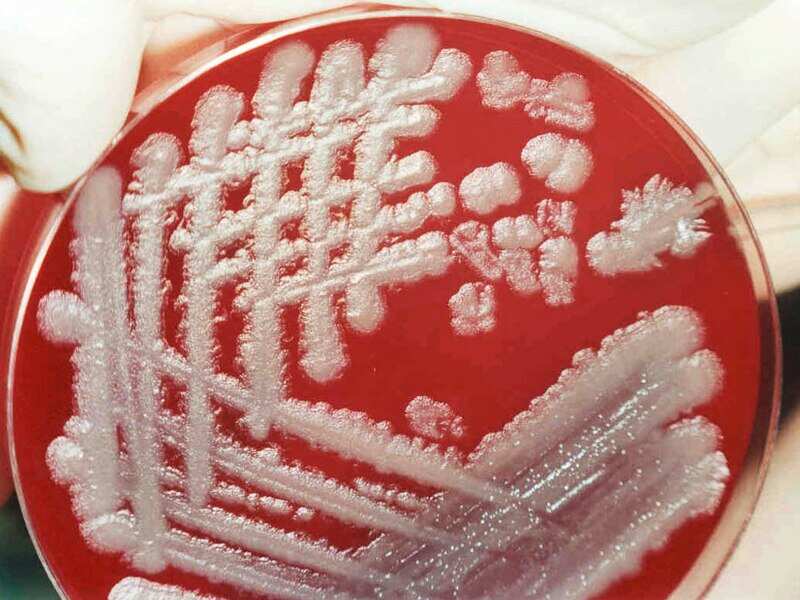 A 2 day old cultured anthrax growth