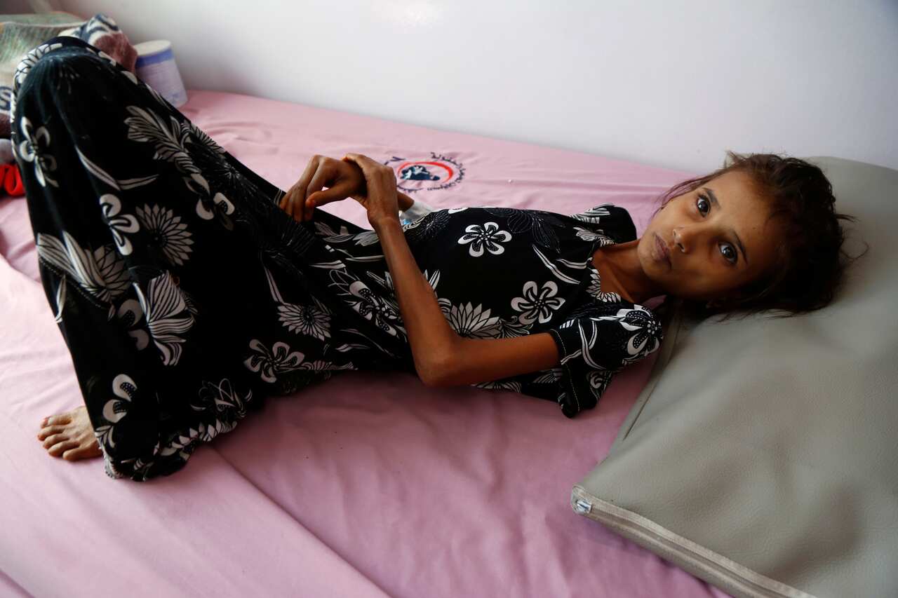 A 13-year-old Yemeni girl, Ahmadiah Abduh weighs only 11 kilos as she undergoes treatment for malnutrition at the Al-Sabeen hospital in Yemen, on 3 February.