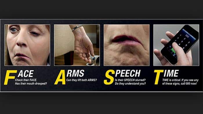 FAST (Face, Arms, Speech, Time)