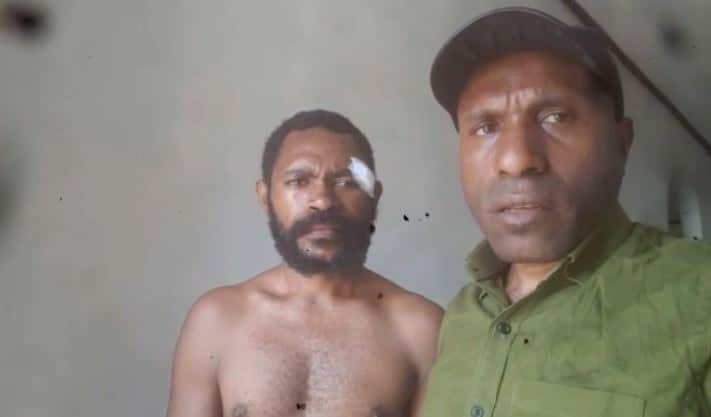 Andi Ogetai says he was injured by pro-government militia. He's pictured with West Papua National Committee activist Victor Yeimo.