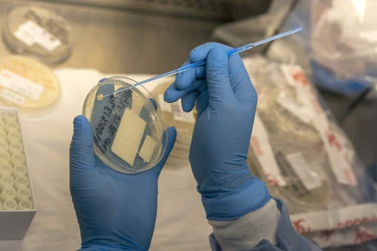 New TB Vaccine Could Save Millions of Lives, Study Suggests