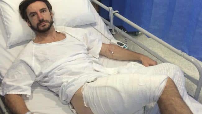 Gareth Clear, 35, was burnt by what he said was an exploding iPhone.