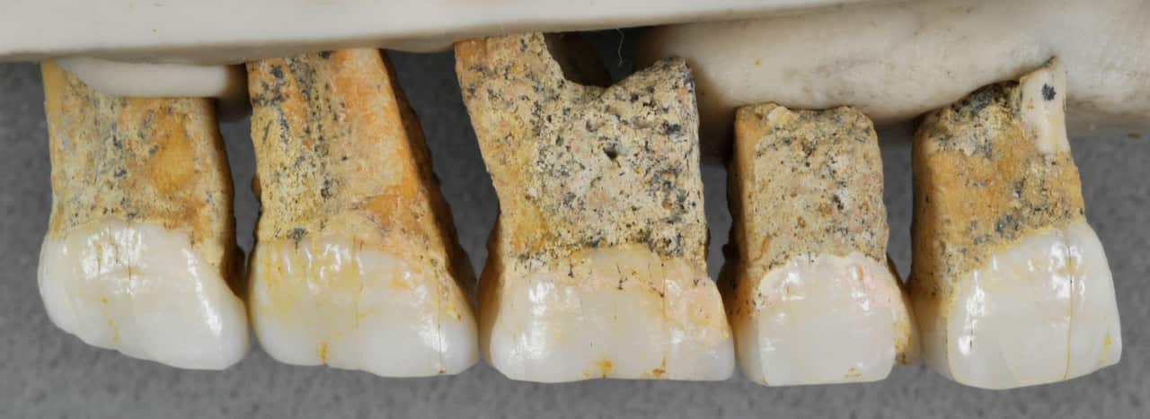 Right upper teeth of the newly discovered species Homo Iuzonensis.