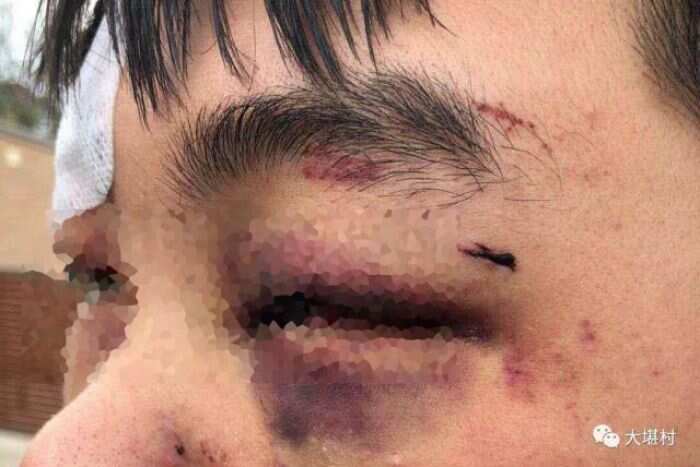 Chinese high school students allegedly bashed by youths at Canberra bus stop.