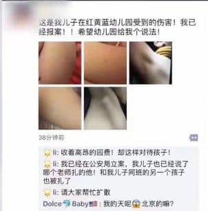 疑似被扎针眼