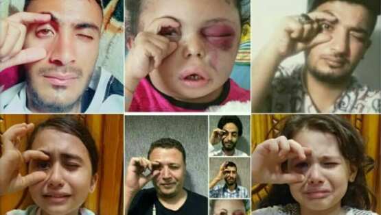 Social media users post photographs of themselves in the same pose with the hashtag “Buthaina” or “Picture Ur eye 4 Bothinah”.