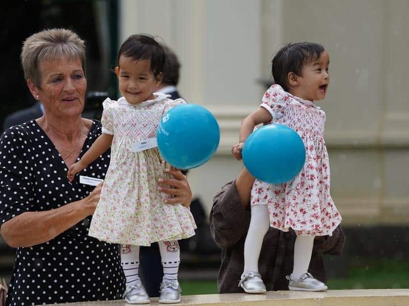 Previously conjoined sisters Nima and Dawa.