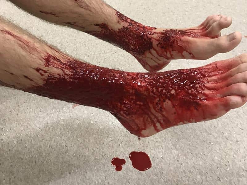 Sam Kanizay in a Melbourne Hospital