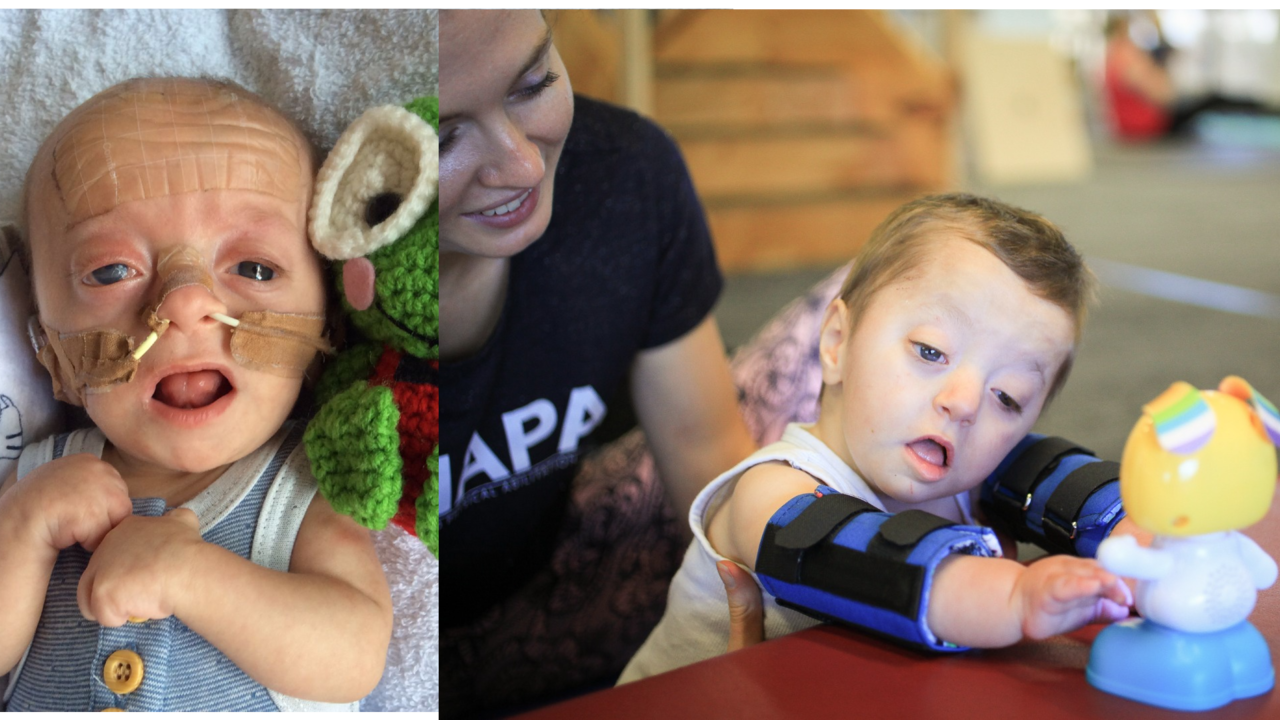 Alexander close up younger and at therapy