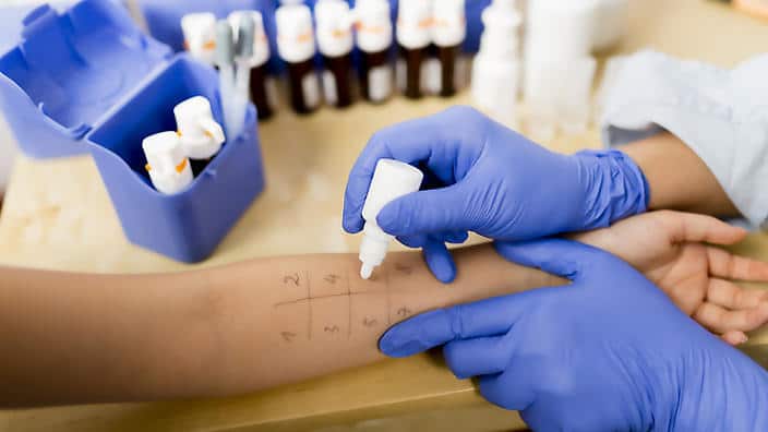 common allergies in Australia