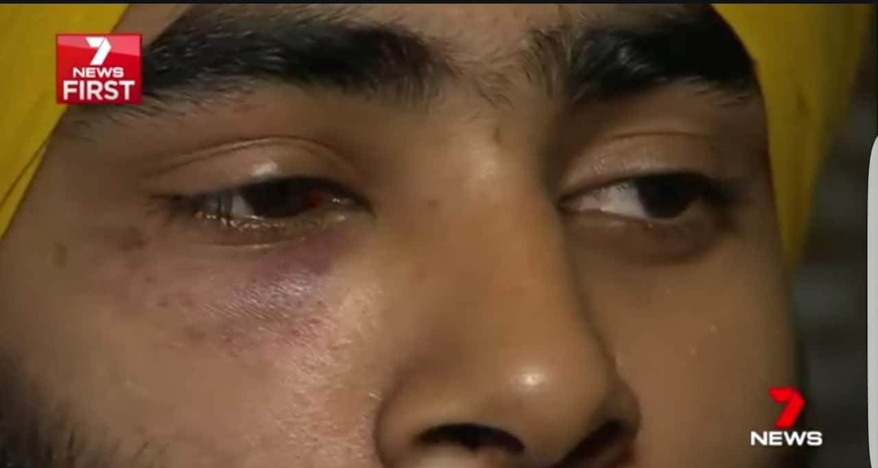 Indian international student attacked in Melbourne