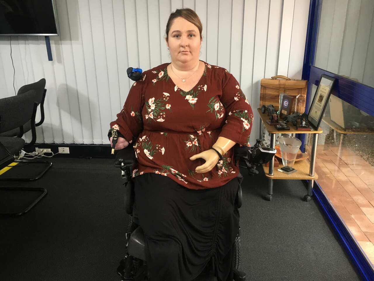 瓦倫丁女士（Korina Valentine）最初以為只是流感，但卻因敗血症而要截去四肢。