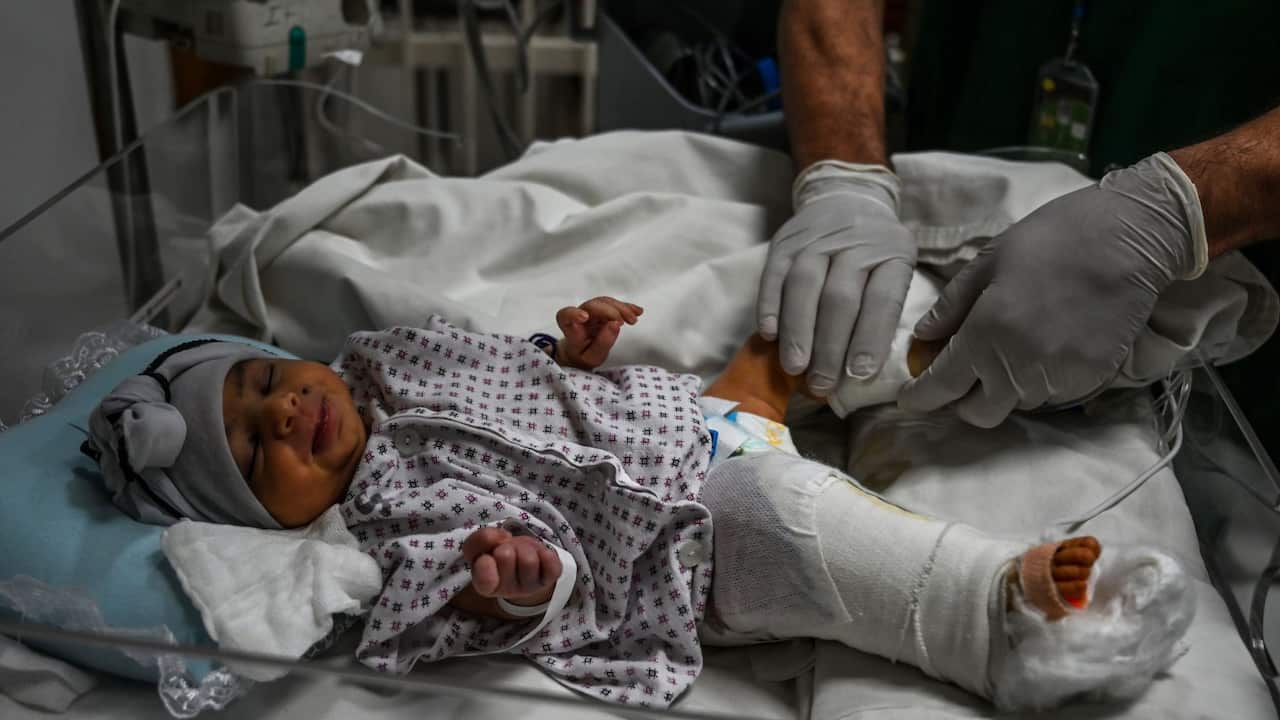 After losing her mother in the attack, newborn baby Bibi Amena, receives treatment for gun wound in her right leg as she has been rescued and brought to the French Medical Institute for Children.