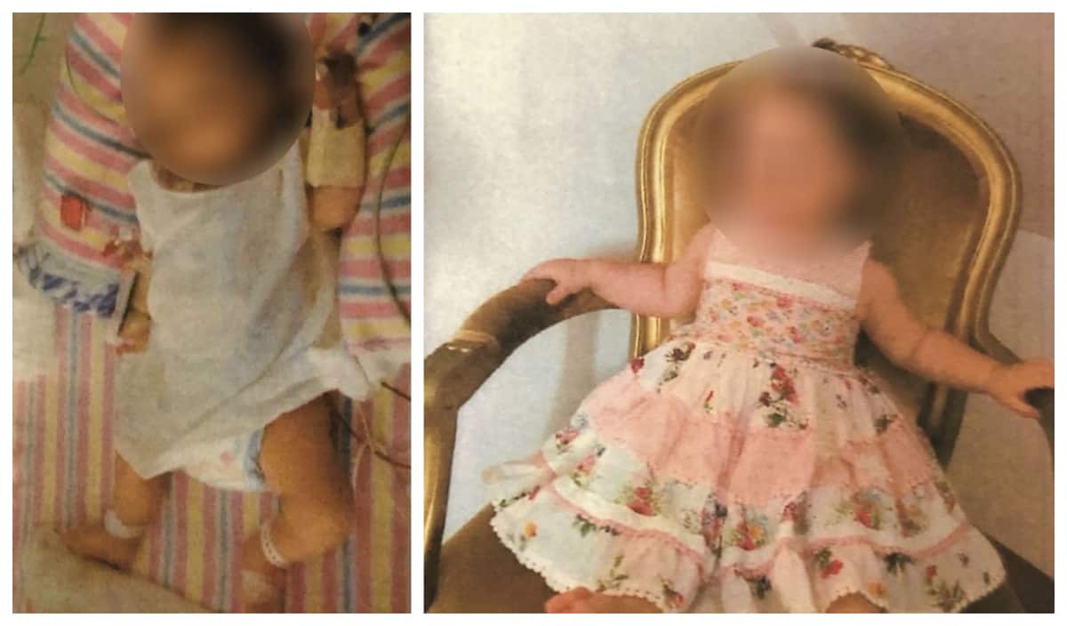 The girl, now aged three, was so malnourished by the time she was 19 months old