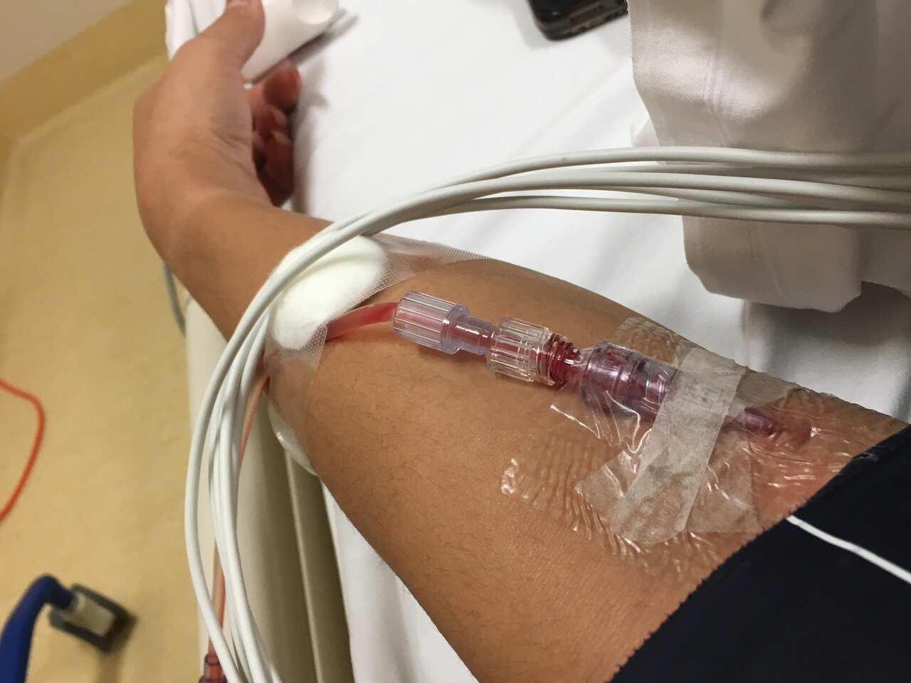 คุณเบียร์เล่าว่ามีช่วงหนึ่งขณะอยู่ที่โรงพยาบาลเธอต้องถูกเจาะเลือดไปตรวจทุก 2 ชั่วโมงตลอดทั้งวันทั้งคืน