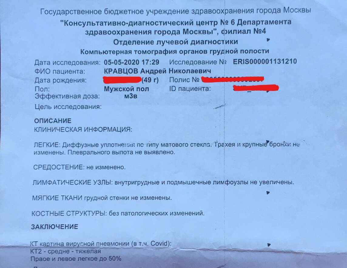 Andrei Kravtsov got coronavirus, CT scan results