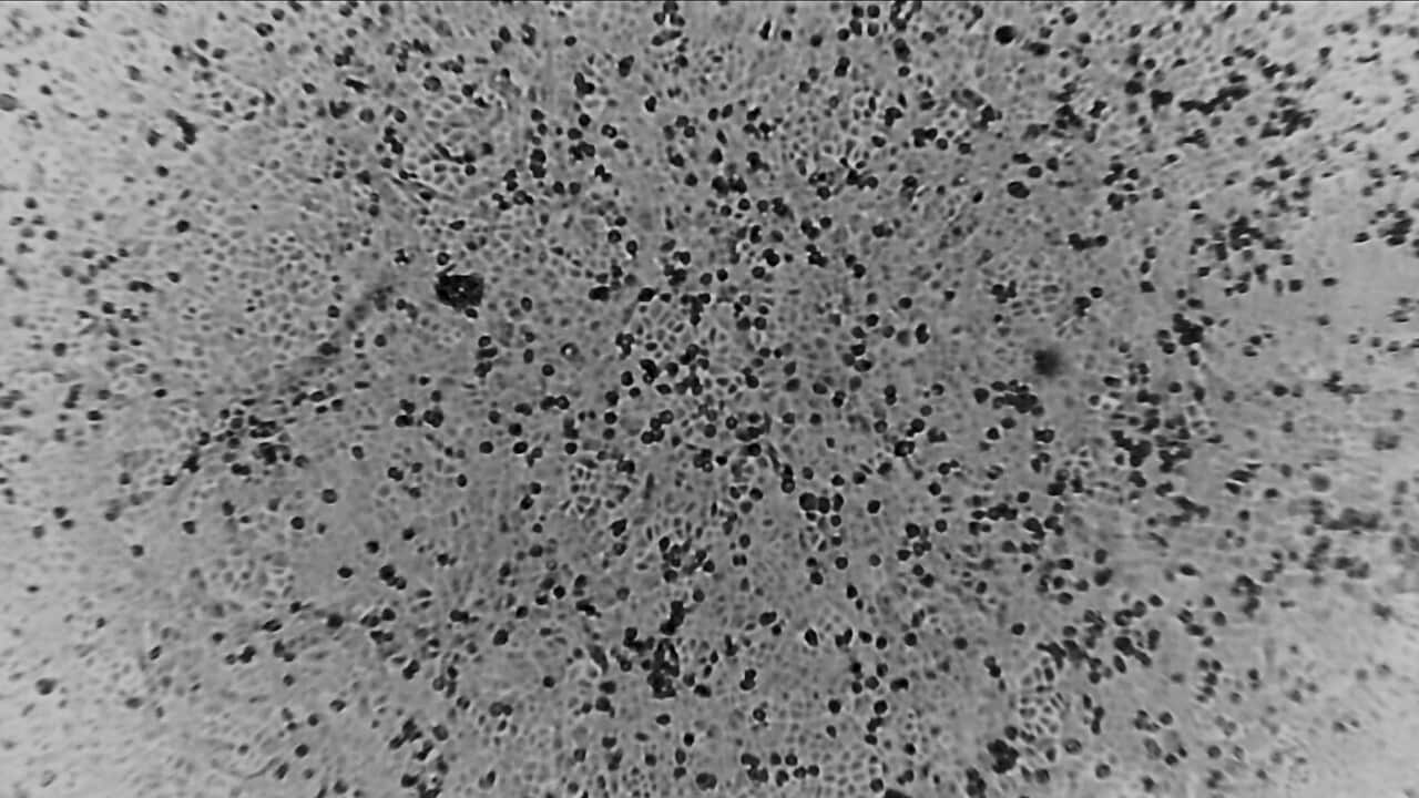 Scientists from The Peter Doherty Institute for Infection and Immunity were able to succesfully grow a version of the Coronavirus in January.