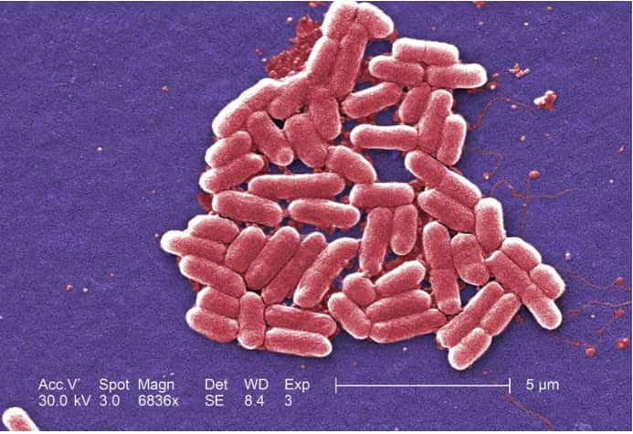 If someone eats food contaminated with E. coli, they may become seriously ill. (PA/AAP)