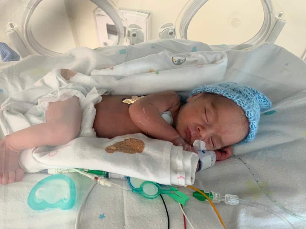 Jonty, bebé de Diana Mozo, al poco de nacer de forma prematura