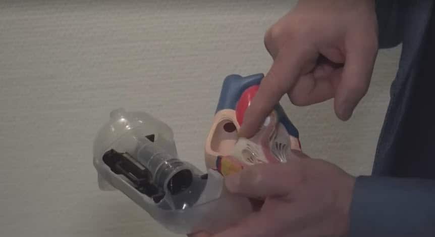 Dr Azad Najar ponting at his invention