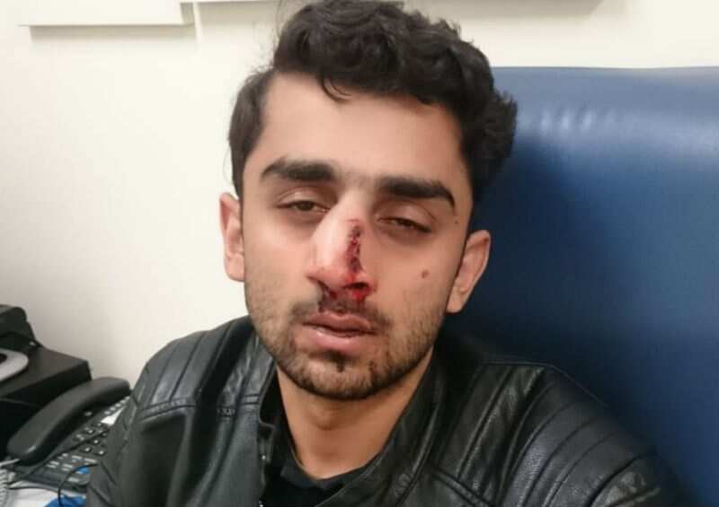 Abdullah Qaiser after he was attacked on campus.