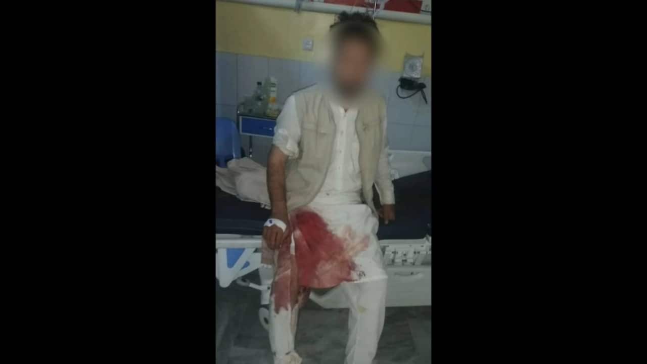 The man being treated in hospital