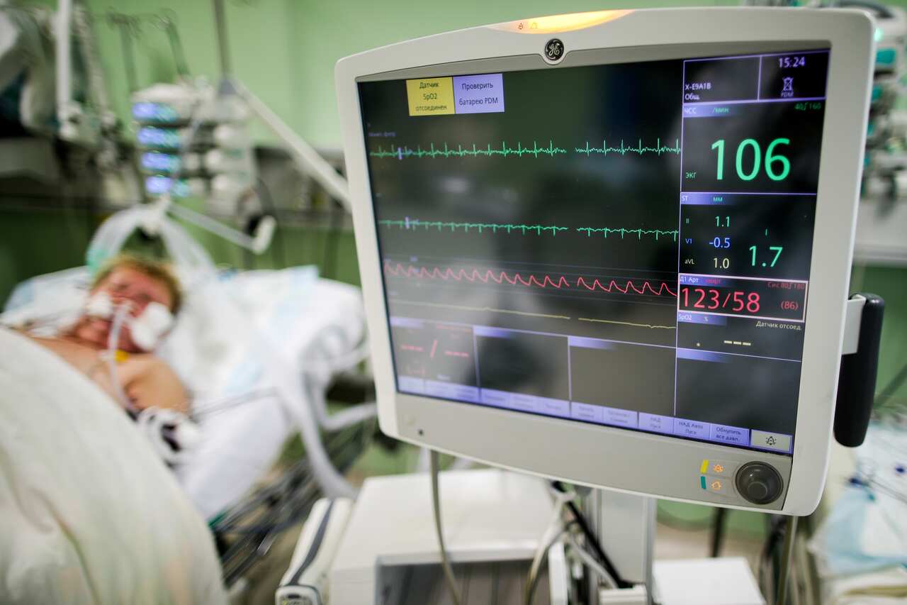 The study found 149 people have been admitted to an ICU in Australia with coronavirus symptoms.