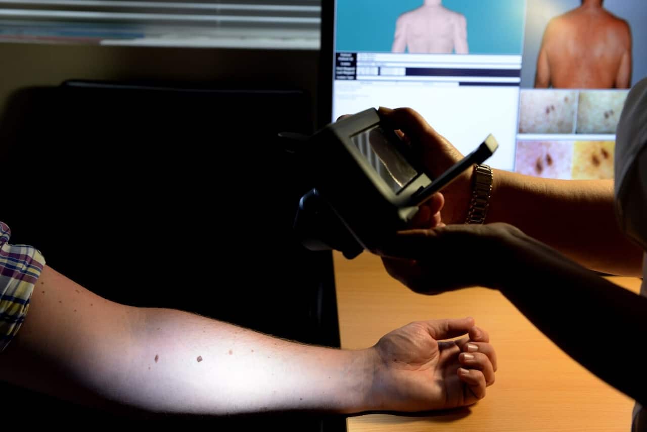 File image of a skin cancer check