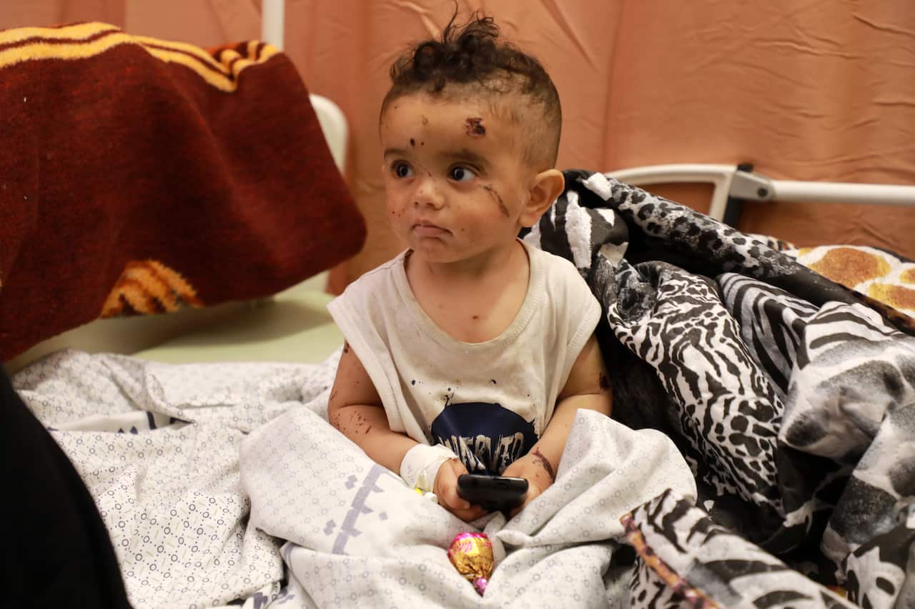 A Palestinian child, who was wounded in Israeli air strikes on the Gaza Strip, receives treatment at Al-Shifa Hospital on 16 May, 2021.