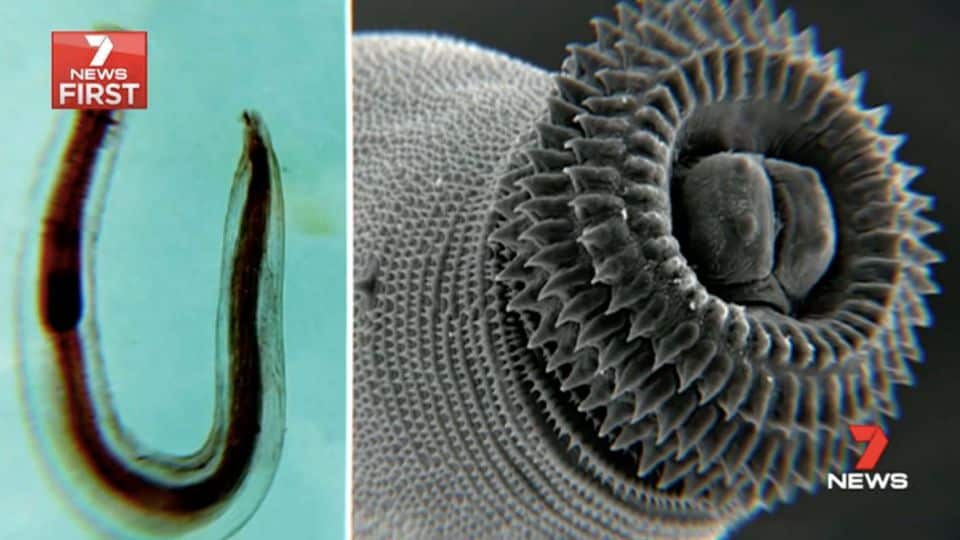 寄生蟲可入侵人體所有器官，甚至大腦，由於寄生蟲有牙齒，會在體內各處嚼食各種器官組織。